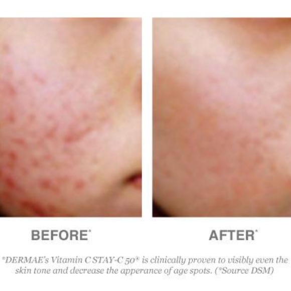 DERMA.E - Picture 2 of 2